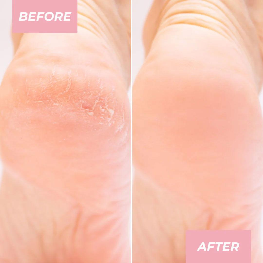 ABSOLUTE NEW YORK | EXFOLIATING FOOT MASK Mayshka