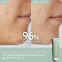 CAUDALIE | VINOPURE GELEE NETTOYANTE PURIFIANTE Mayshka