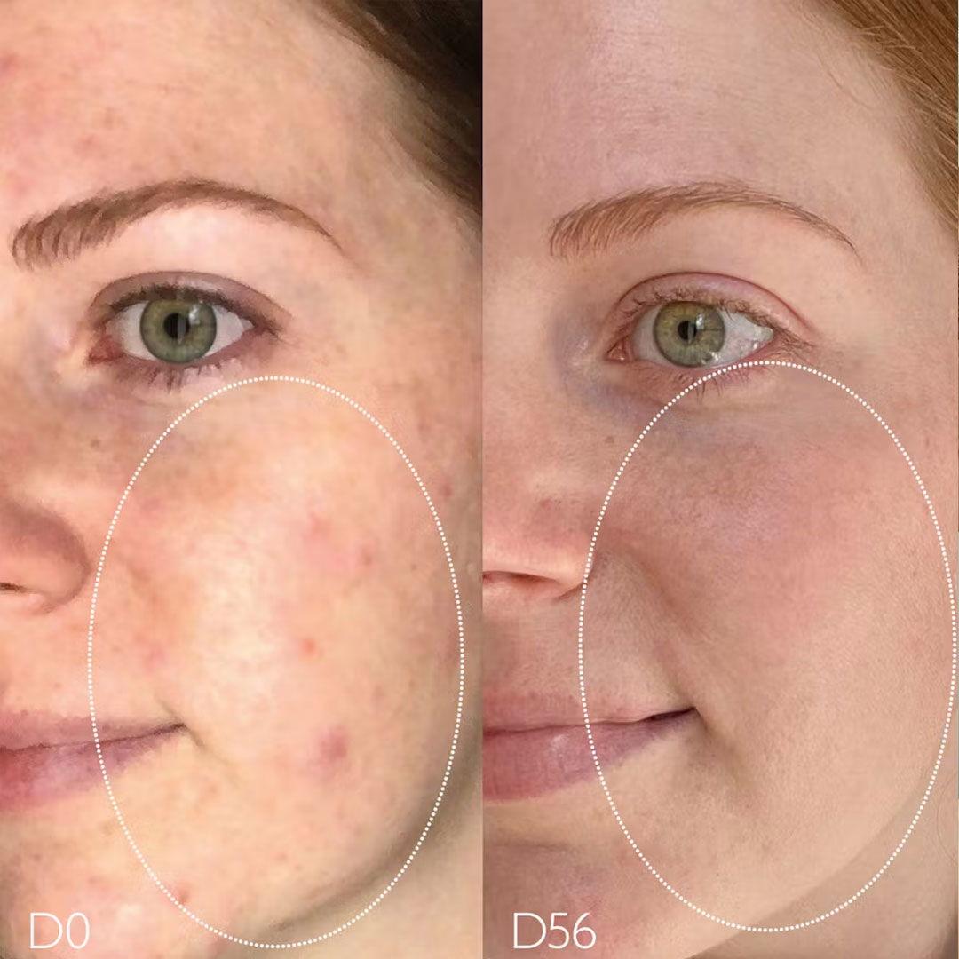 CAUDALIE | VINOPURE LOTION PURIFIANTE Mayshka