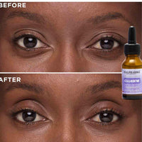 ITALPHARMA | CONTOUR DE YEUX AU COLLAGENE - Mayshka