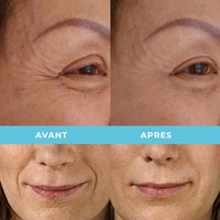 ITALPHARMA | CREME VISAGE AU COLLAGENE - Mayshka