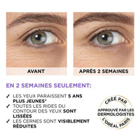 L’ORÉAL PARIS | HYALURON EXPERT SERUM CONTOUR DES YEUX – 2.5% ACIDE HYALURONIQUE Mayshka